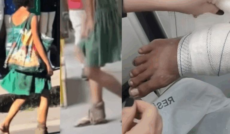 Mulher em situação de rua, ‘famosa’ na internet por causa do pé, recebe curativo em hospital de Manaus