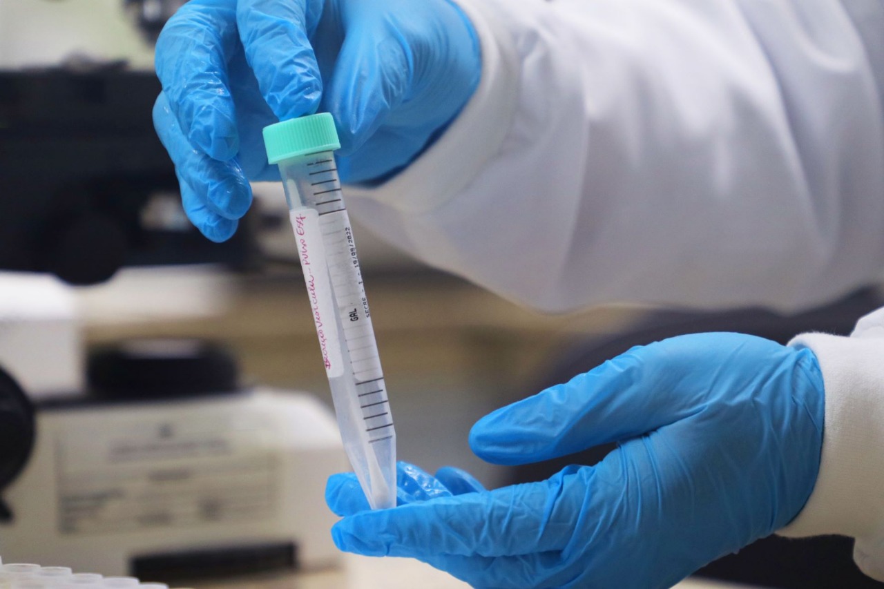 Panorama Epidemiológico da Mpox é atualizado no Amazonas, nesta quarta-feira (7)