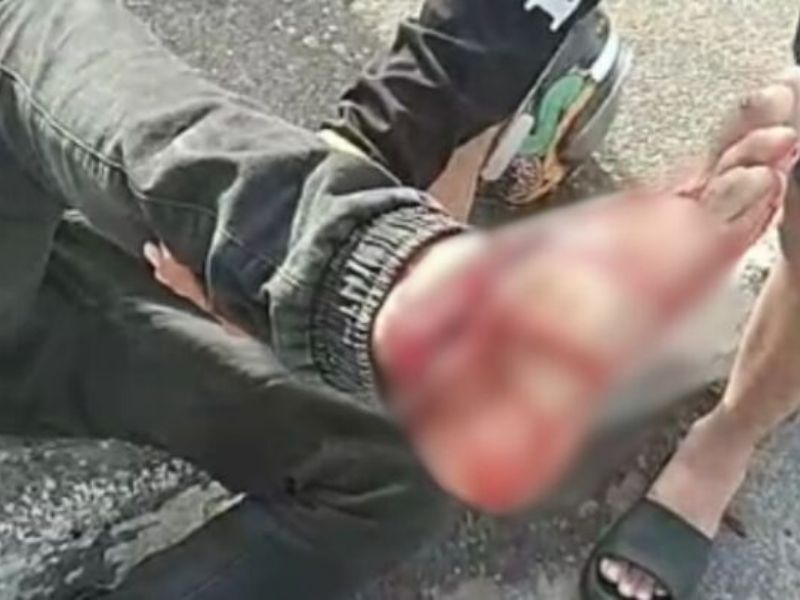 IMAGENS FORTES: Motociclista fica gravemente ferido após colisão na Bola do Jorge Teixeira, em Manaus