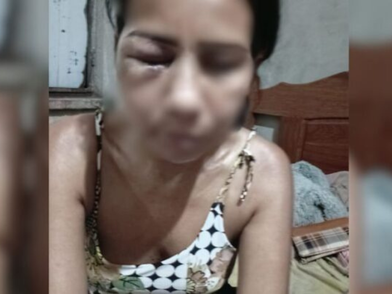 IMAGENS FORTES: Mulher é brutalmente agredida após recusar reconciliação com ex-companheiro no AM